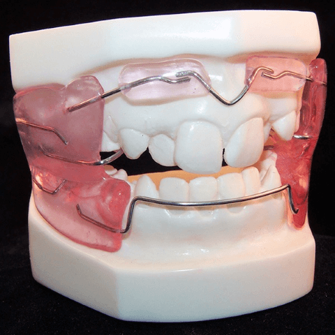 ортодонтический аппарат для исправления прикуса