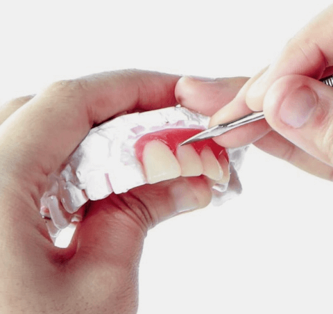 Аутотрансплантация зуба