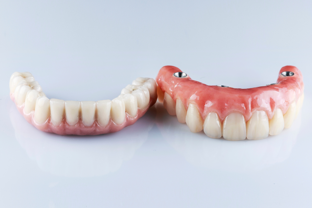 Для чего нужны мостовидные зубные протезы?