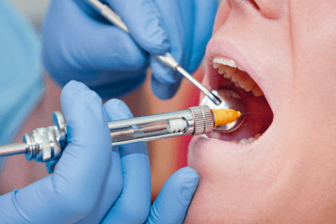 инфильтрационная анестезия в стоматологии