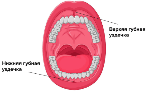 уздечки верхней и нижней губы